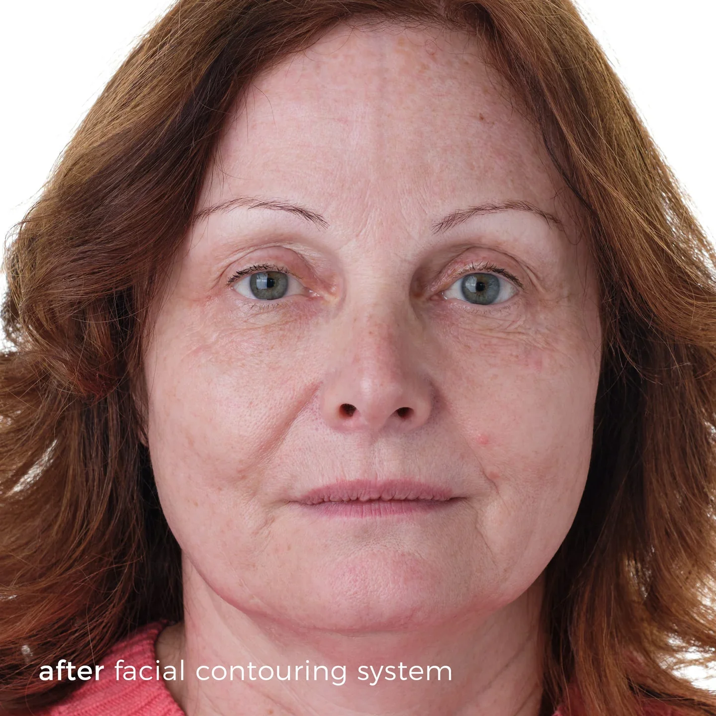 Skinbunny Facial Contouring System with our Blue Tansy Night Oil absolutely FREE - Image 7