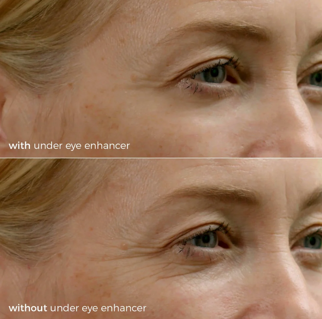Skinbunny Under Eye Enhancer with Facial Contouring System absolutely FREE - Image 4
