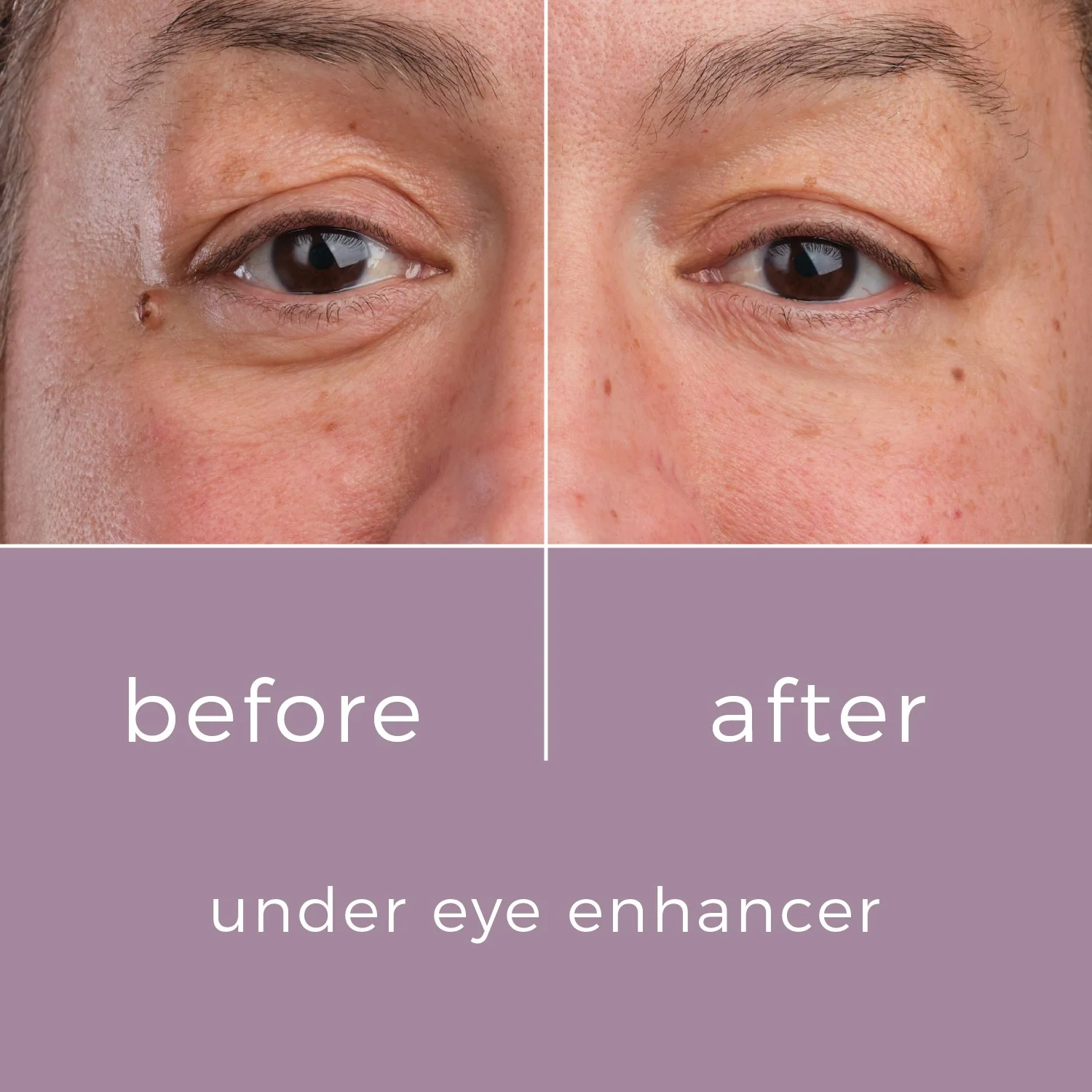 Skinbunny Under Eye Enhancer with Hyaluronic Acid Moisturiser FREE! - Image 11