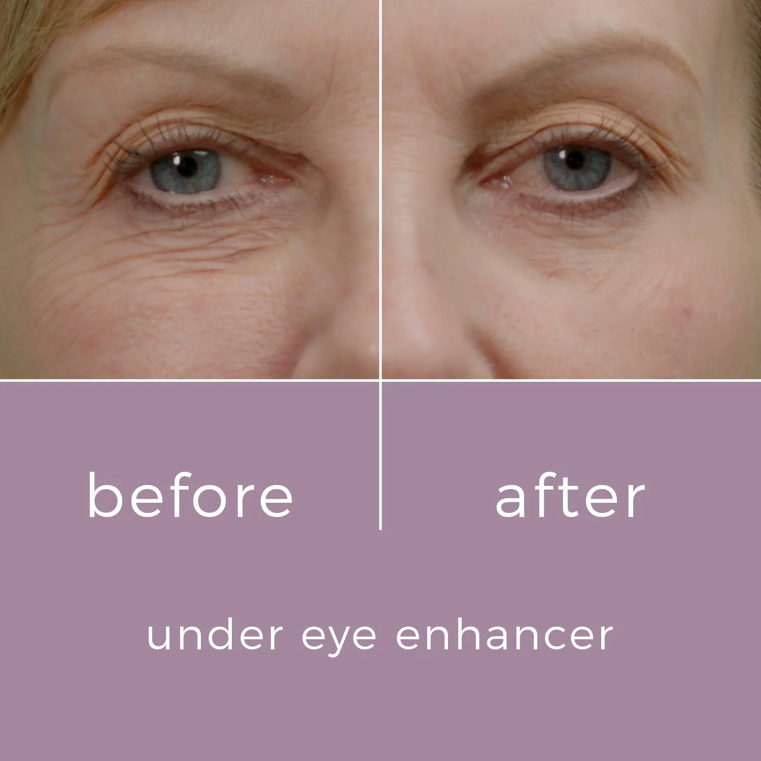 Skinbunny Under Eye Enhancer with Blue Tansy Night Oil absolutely FREE! - Image 4