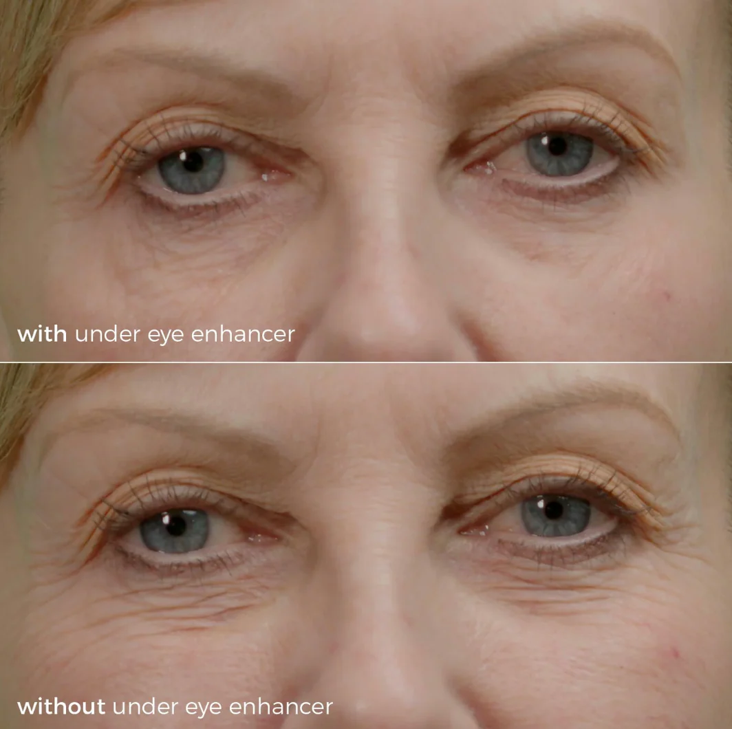 Skinbunny Under Eye Enhancer with Blue Tansy Night Oil absolutely FREE! - Image 5