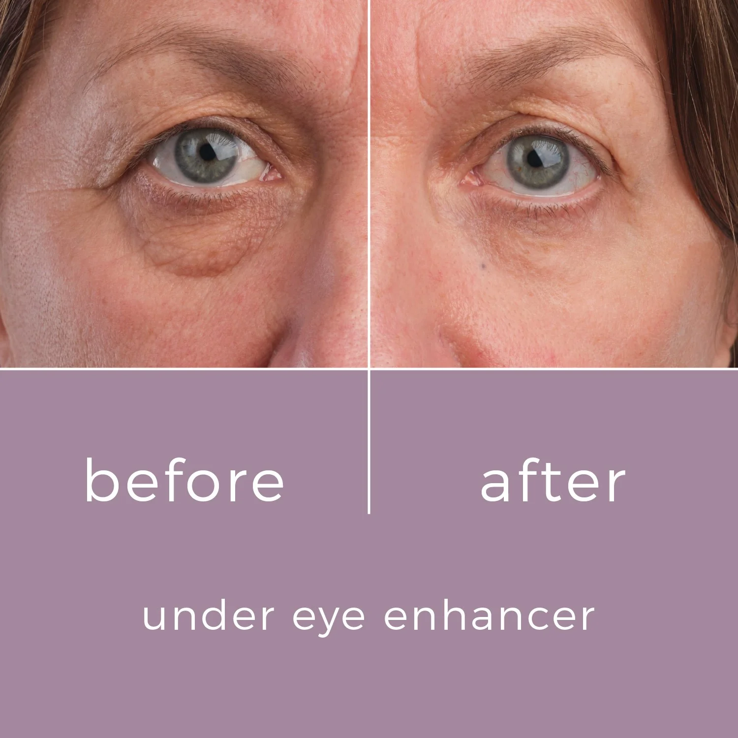 Skinbunny Under Eye Enhancer 100% extra absolutely FREE - Image 10
