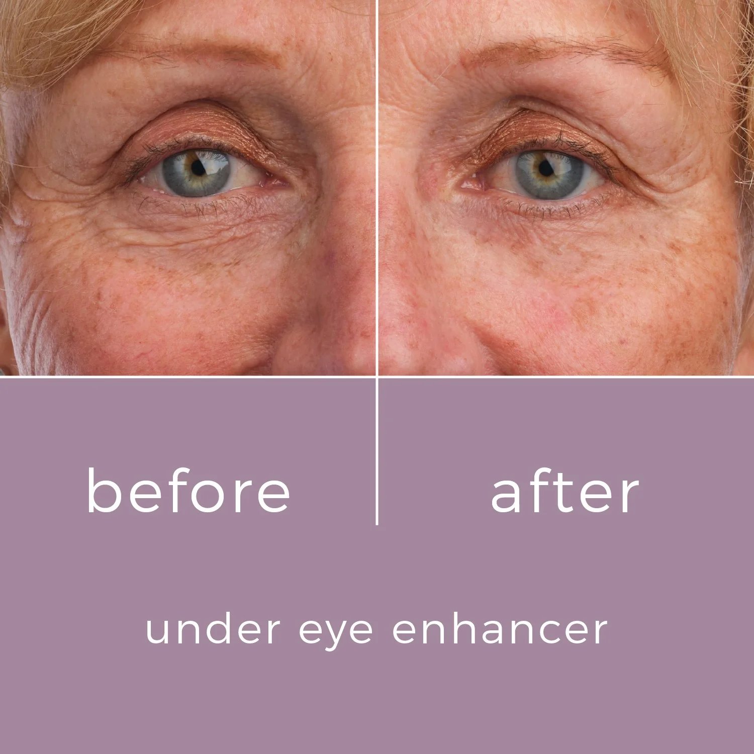 Skinbunny Under Eye Enhancer 100% extra absolutely FREE - Image 9