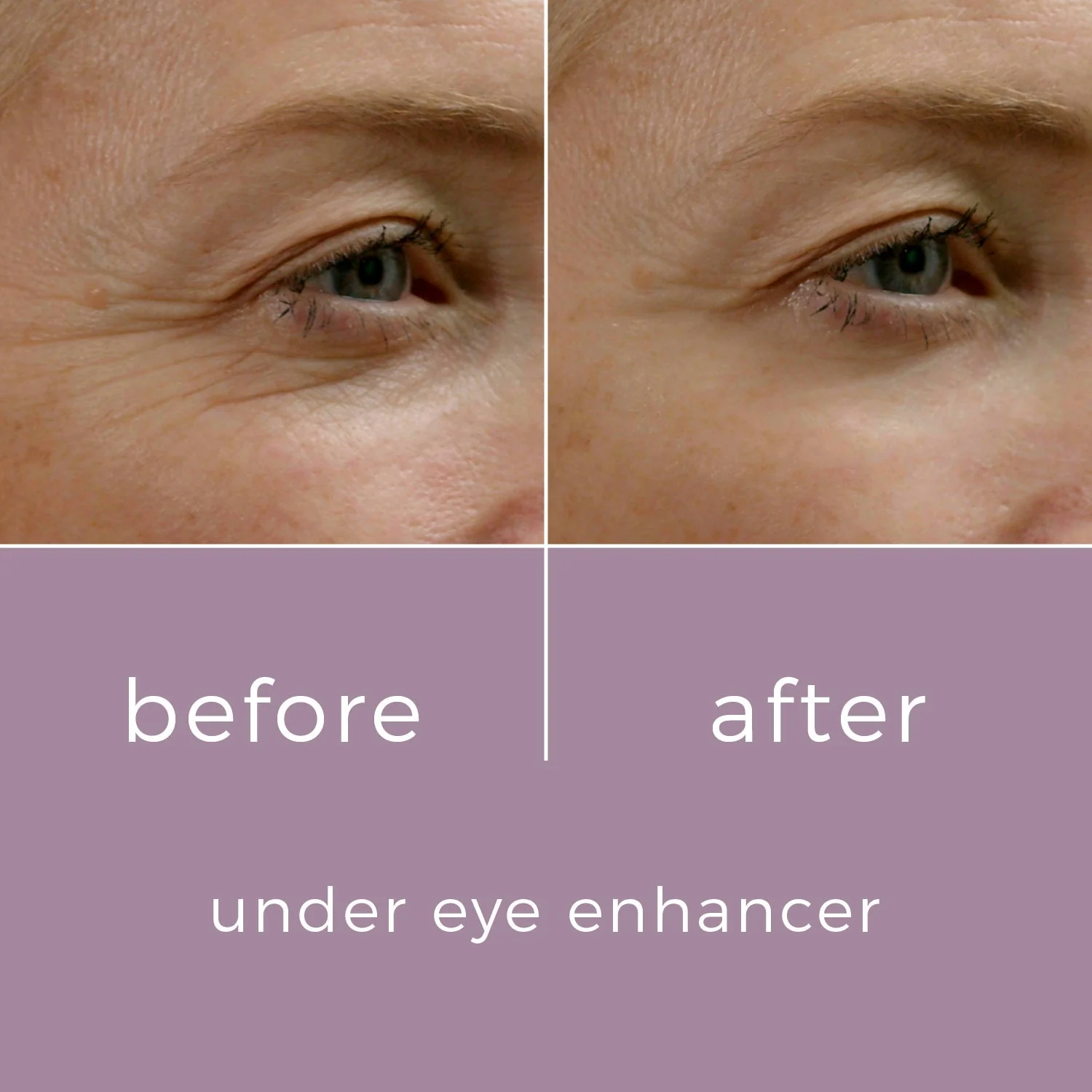 Skinbunny Under Eye Enhancer - Image 5