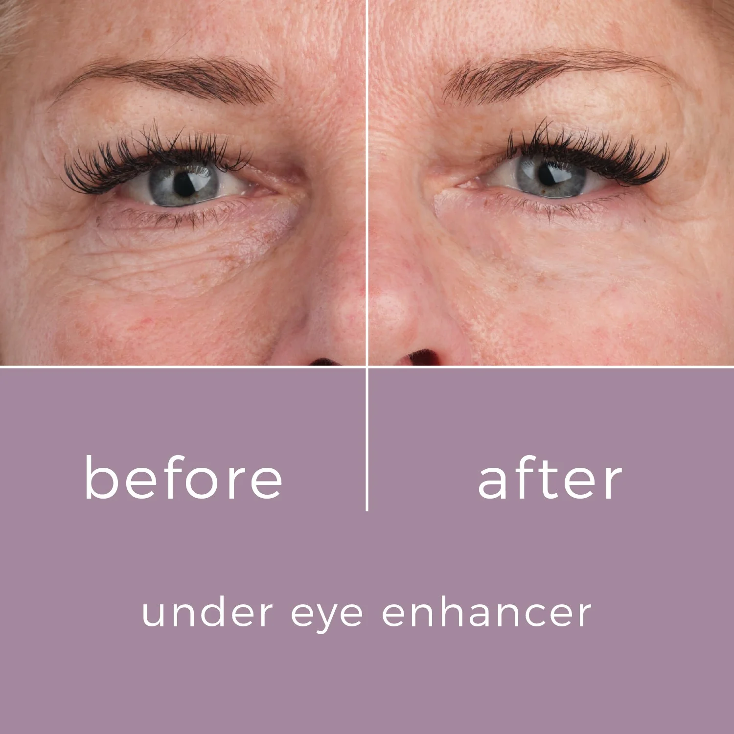 Skinbunny Under Eye Enhancer 100 & FREE Hyaluronic Acid Moisturiser - Image 6